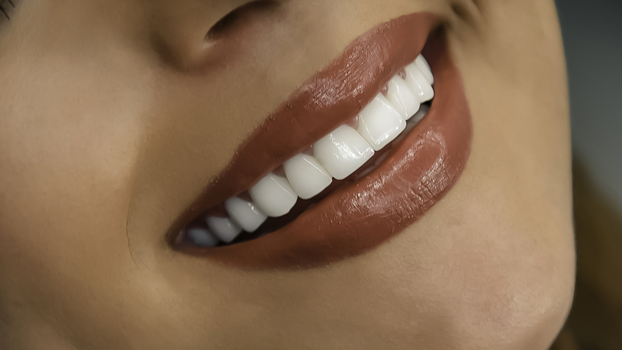 Gülüş Estetiği Nasıl Yapılır?