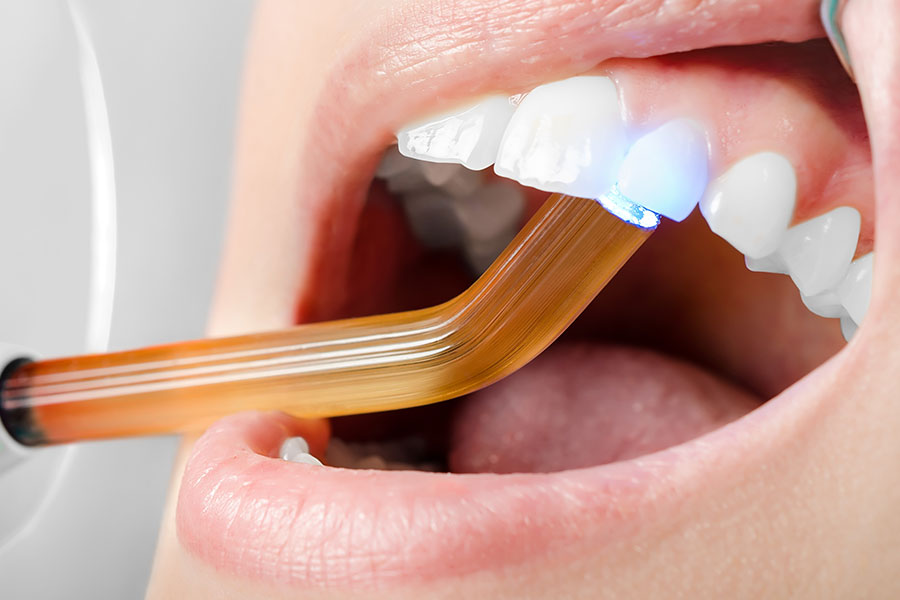 Estetik Diş Dolgusuyla Yeni Bir Sen