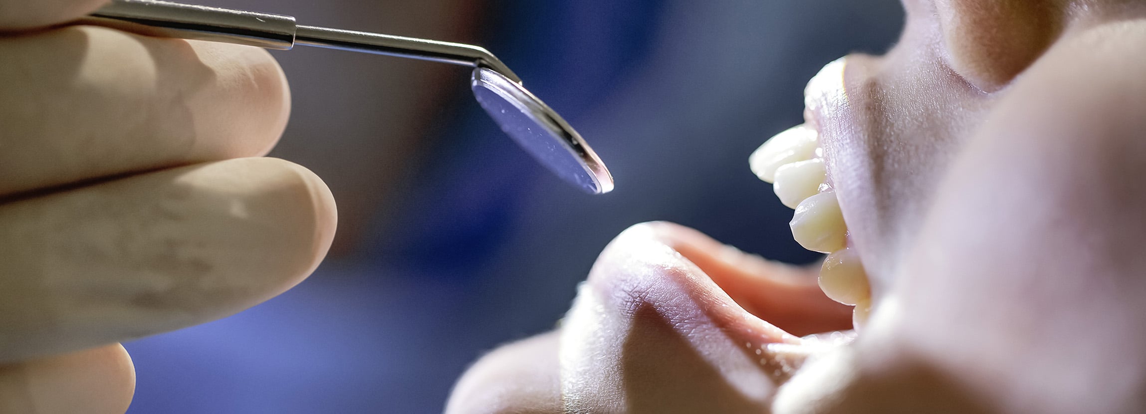 Periodontoloji Nedir ve Nasıl Çalışır?