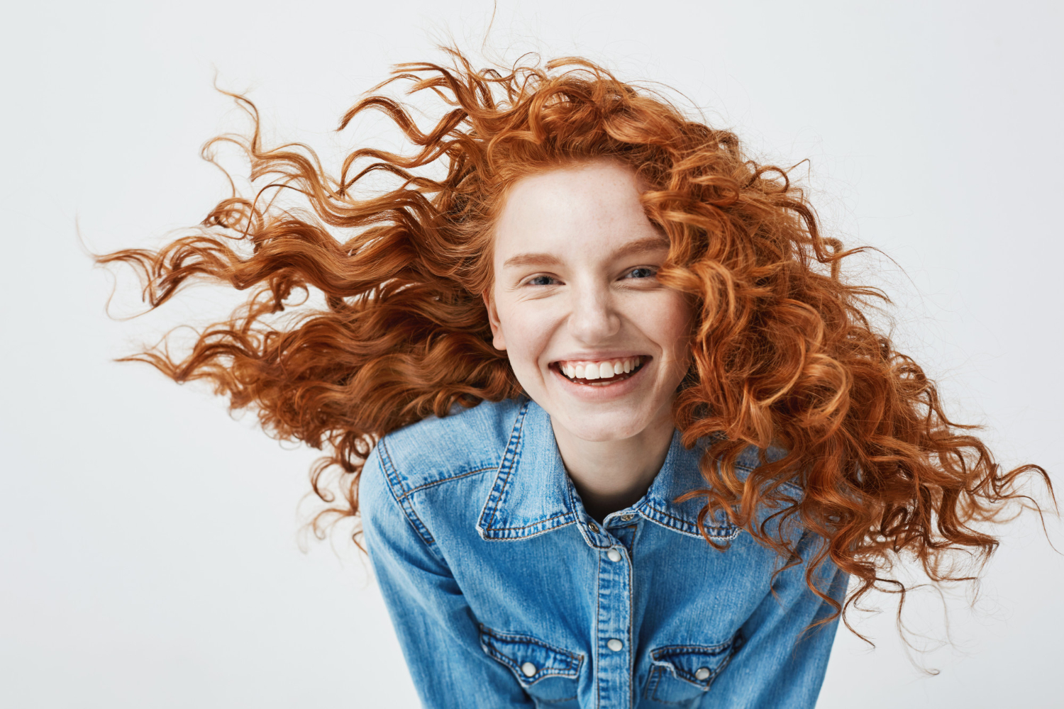 Gummy Smile Tedavisi Kalıcı Mı?