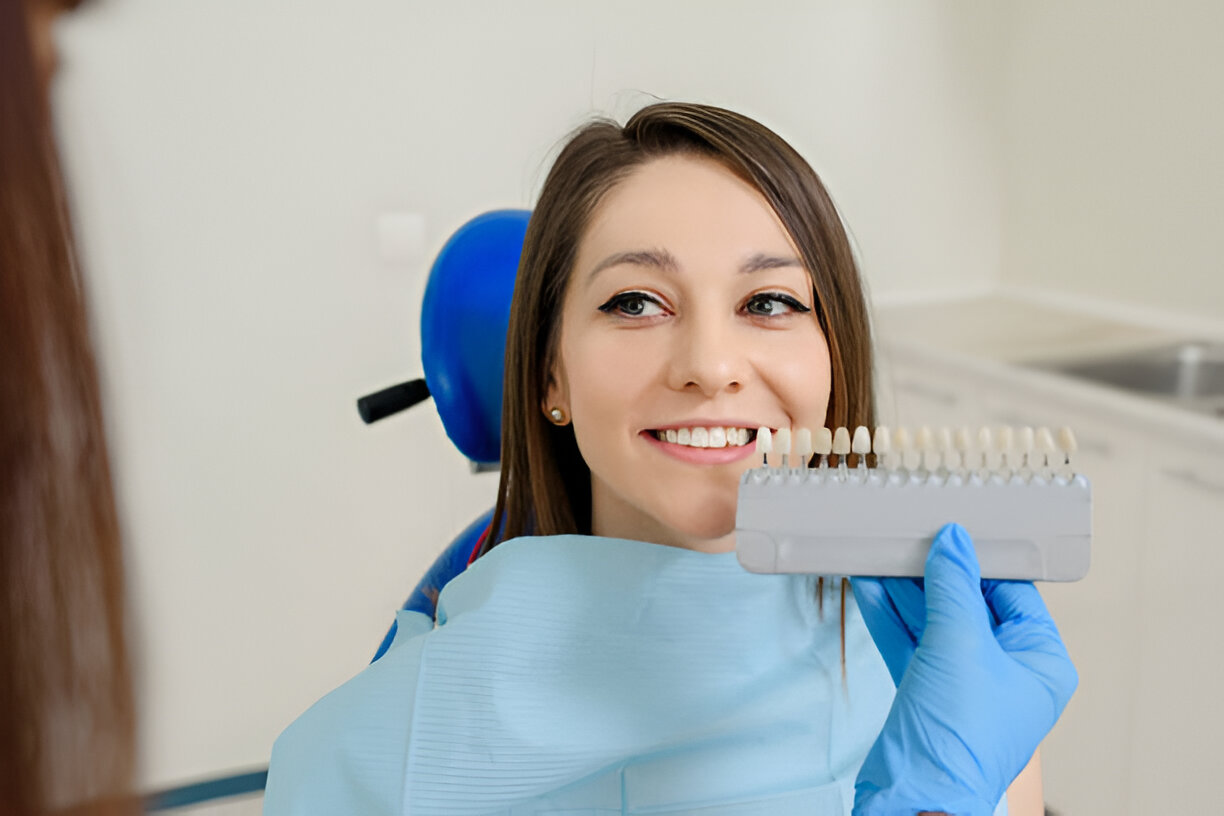 Kompozit Lamine Bonding Hakkında Merak Edilenler